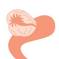 卵巢恶性肿瘤是女性生殖器官常见的恶性肿瘤之一，发病率仅次于子澳门太阳城捕鱼达人_宫颈癌和子宫体癌而列居第三位。但卵巢上皮癌死亡率却占各类妇科肿瘤的首位，对妇女生命造成严重威胁。