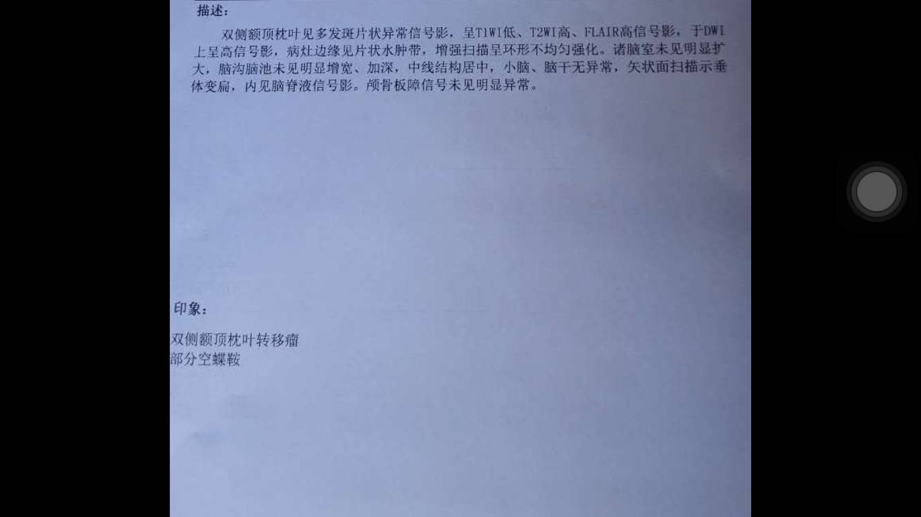 肺癌脑转年后ct结论,大家有没遇到同样症状