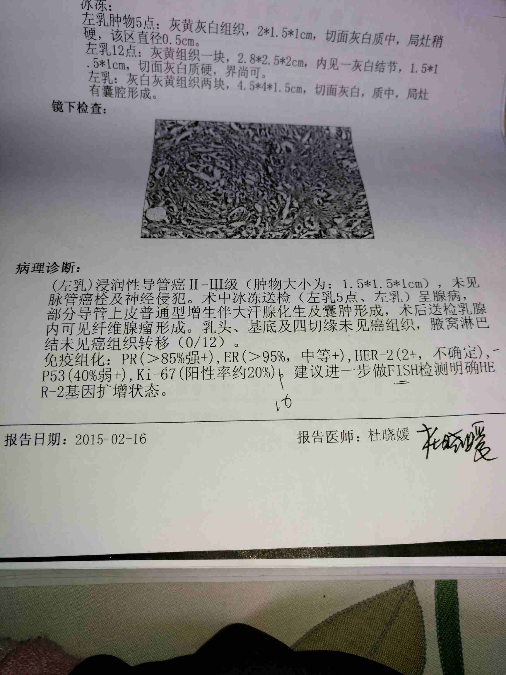 我是乳腺癌患者谁帮我看下这报告多谢