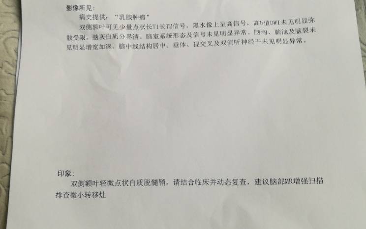 术后一年第二次复查,脑部磁共振提示双侧额叶轻微点状白质脱屑鞘,是