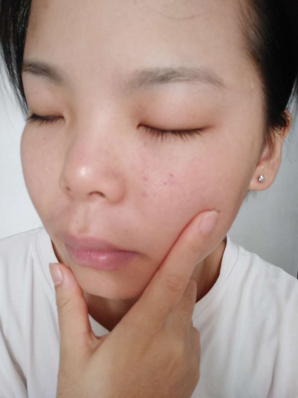 每天早上脸上红血丝特别明显.