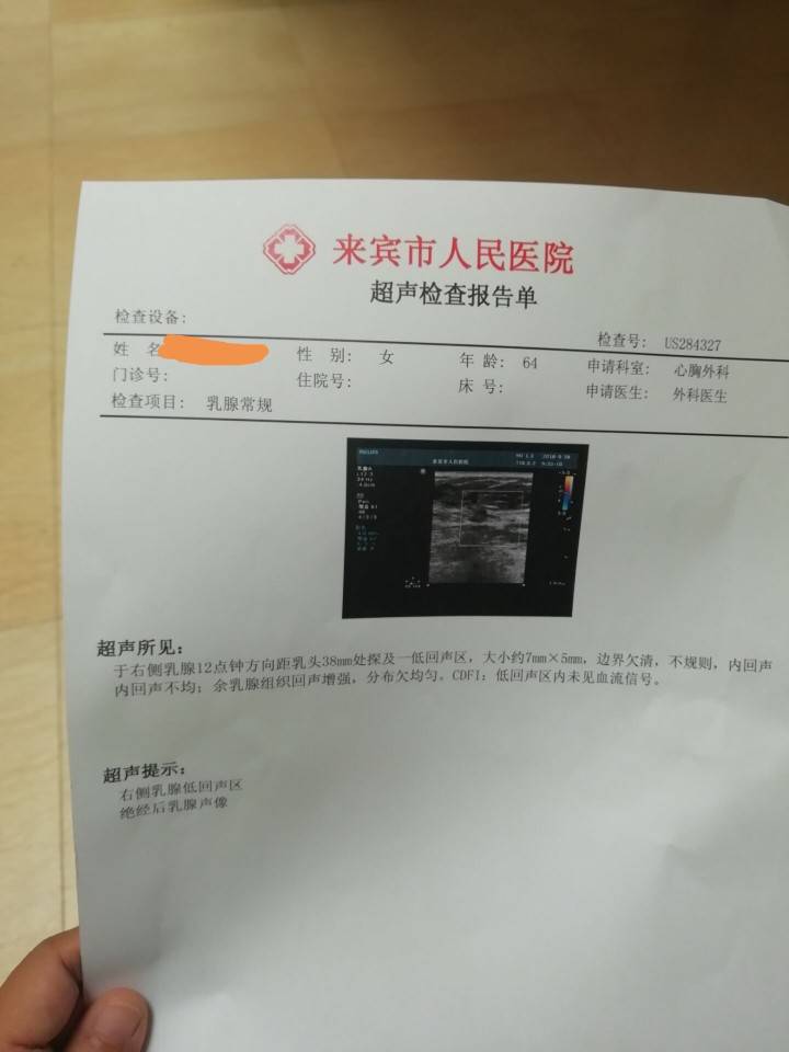 请大家帮看看我妈妈检查的b超,钼靶单子,谢谢