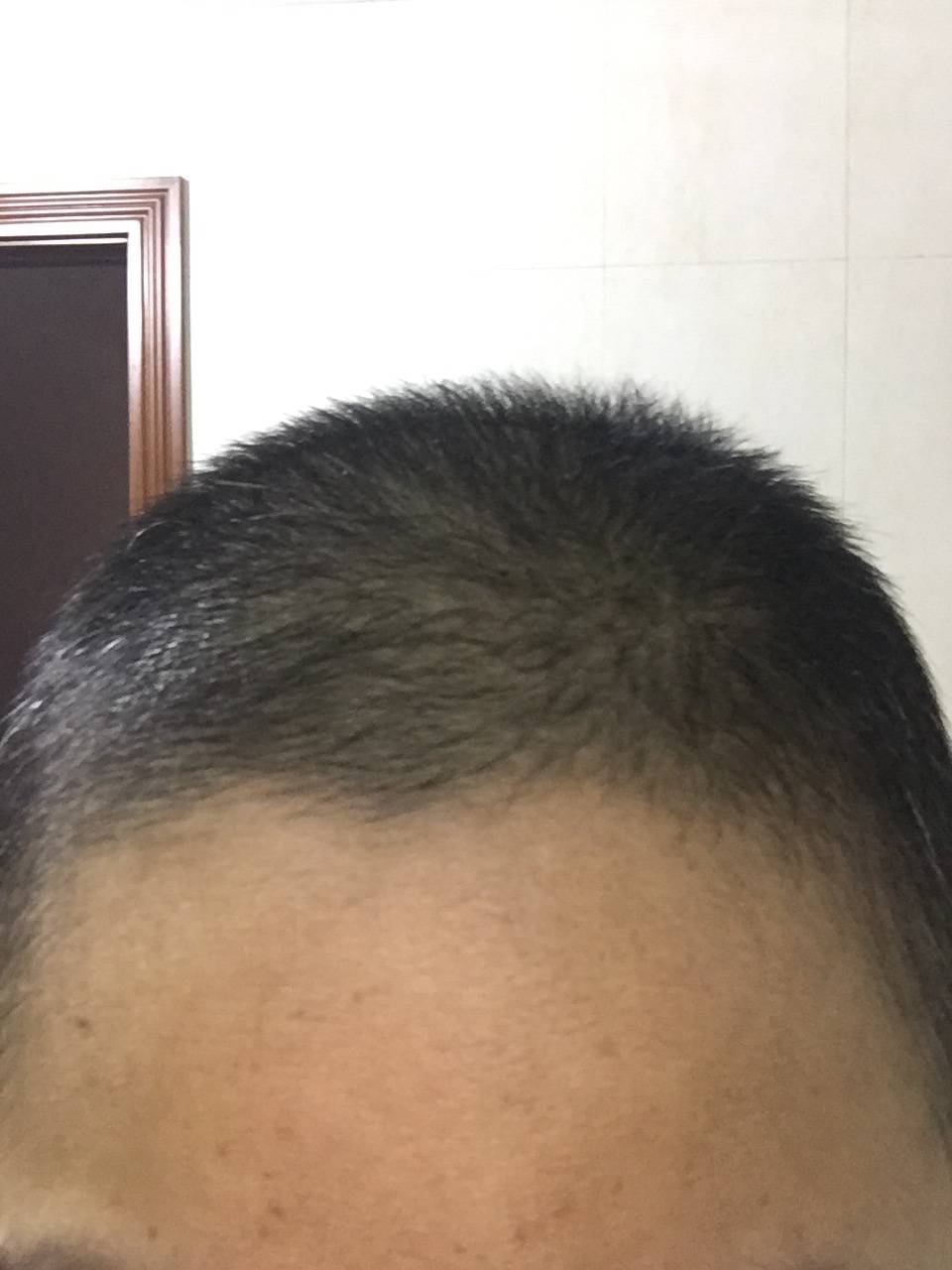 论头发的生长速度.