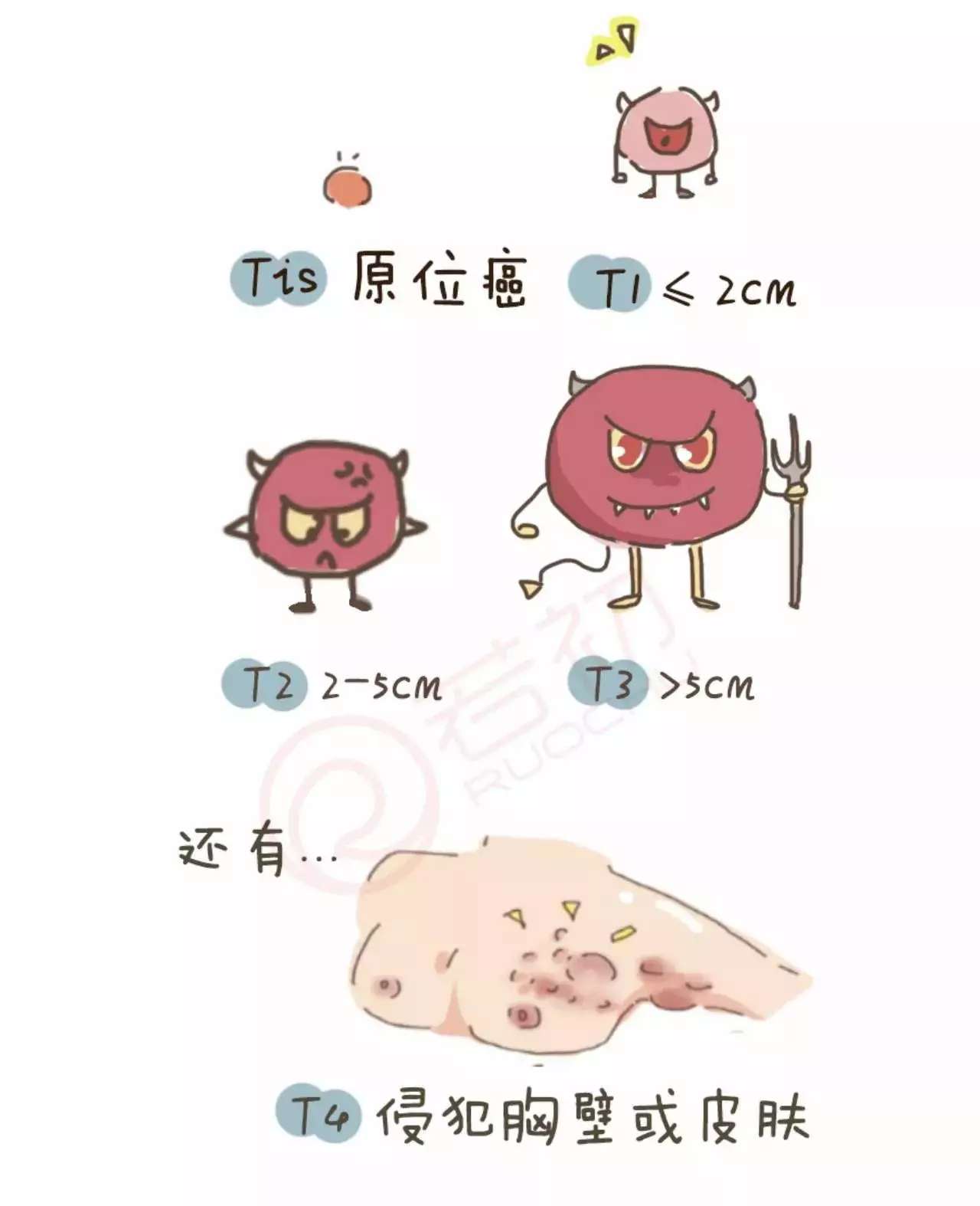 乳腺癌的早期症状和前兆有哪些_布谷医生