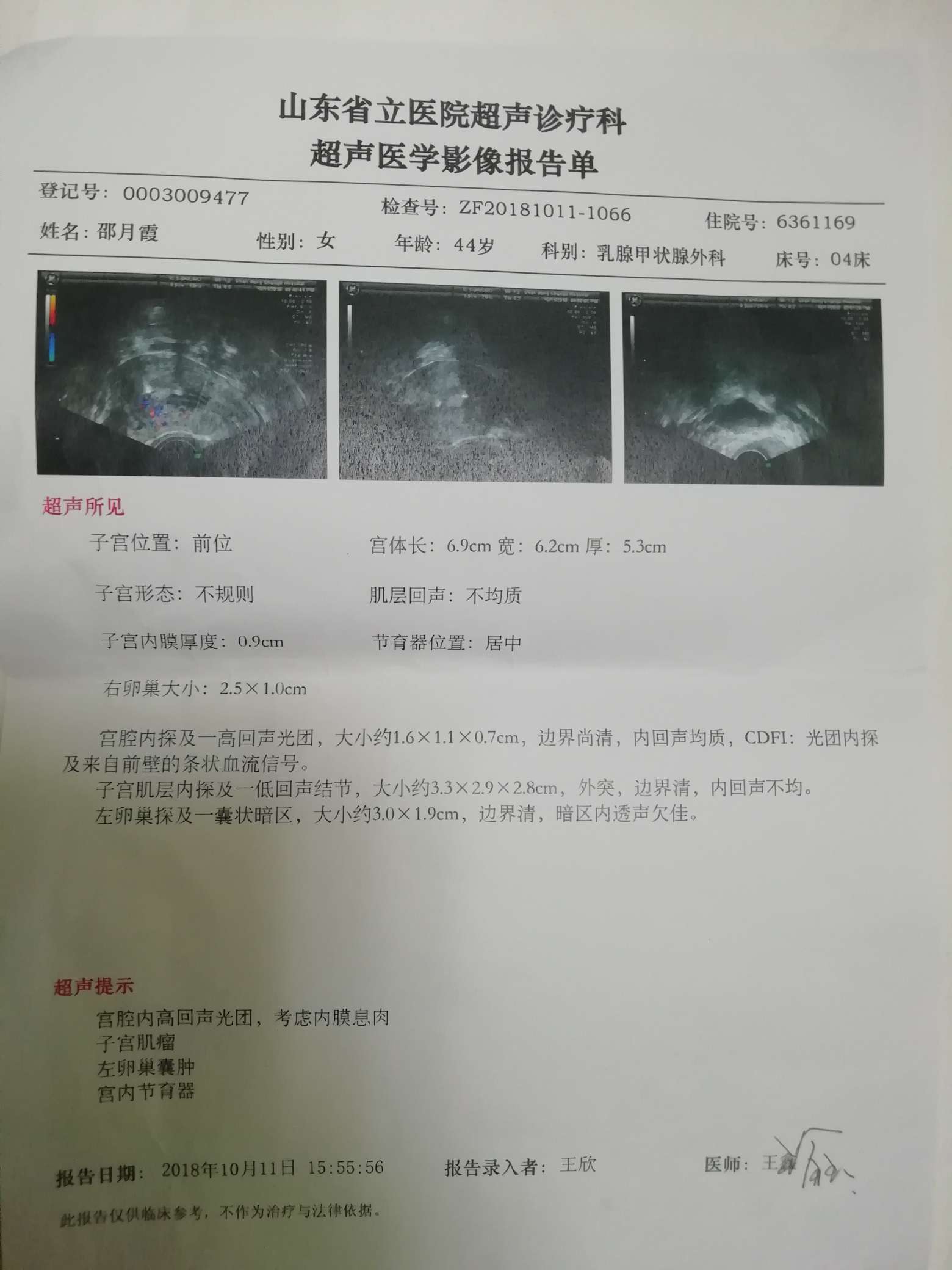治疗结束时查的单子,今天看到有些担心,肺部有纤维灶?