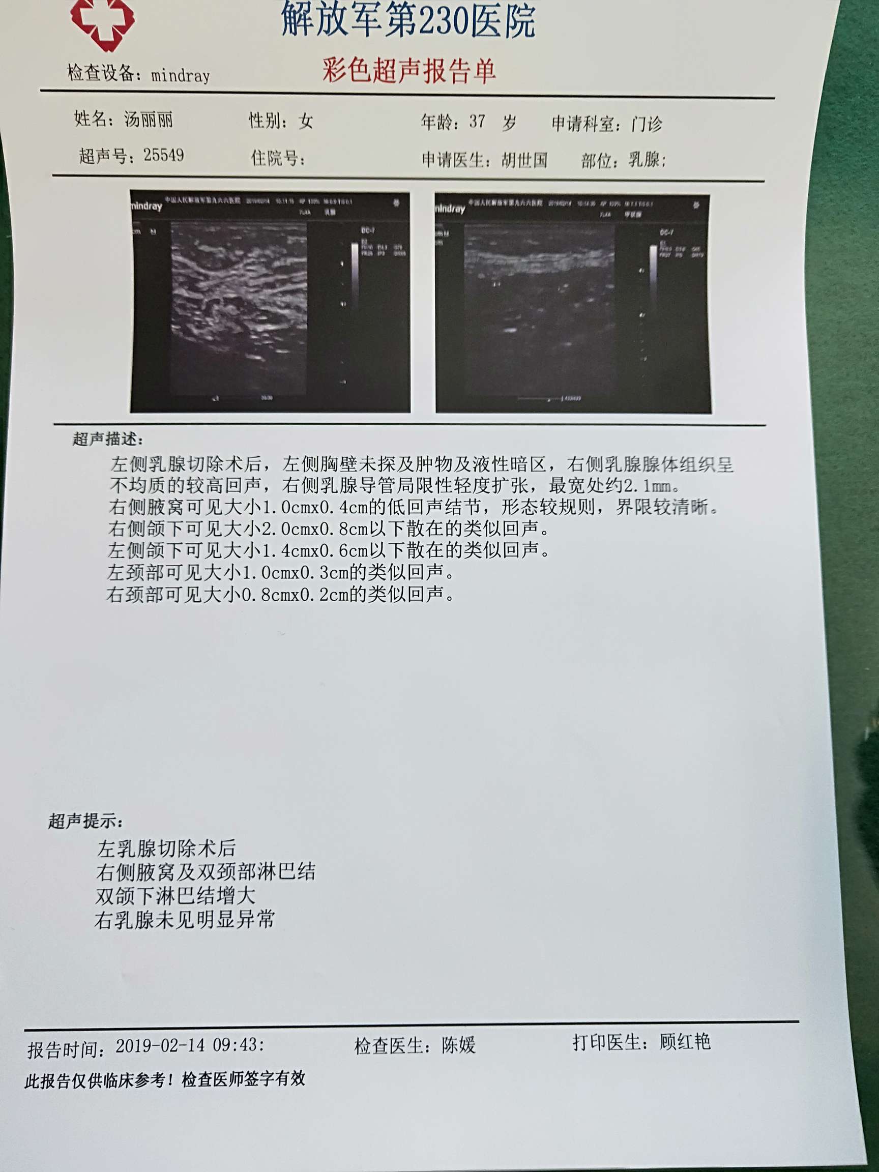 右面腋下有淋巴结?