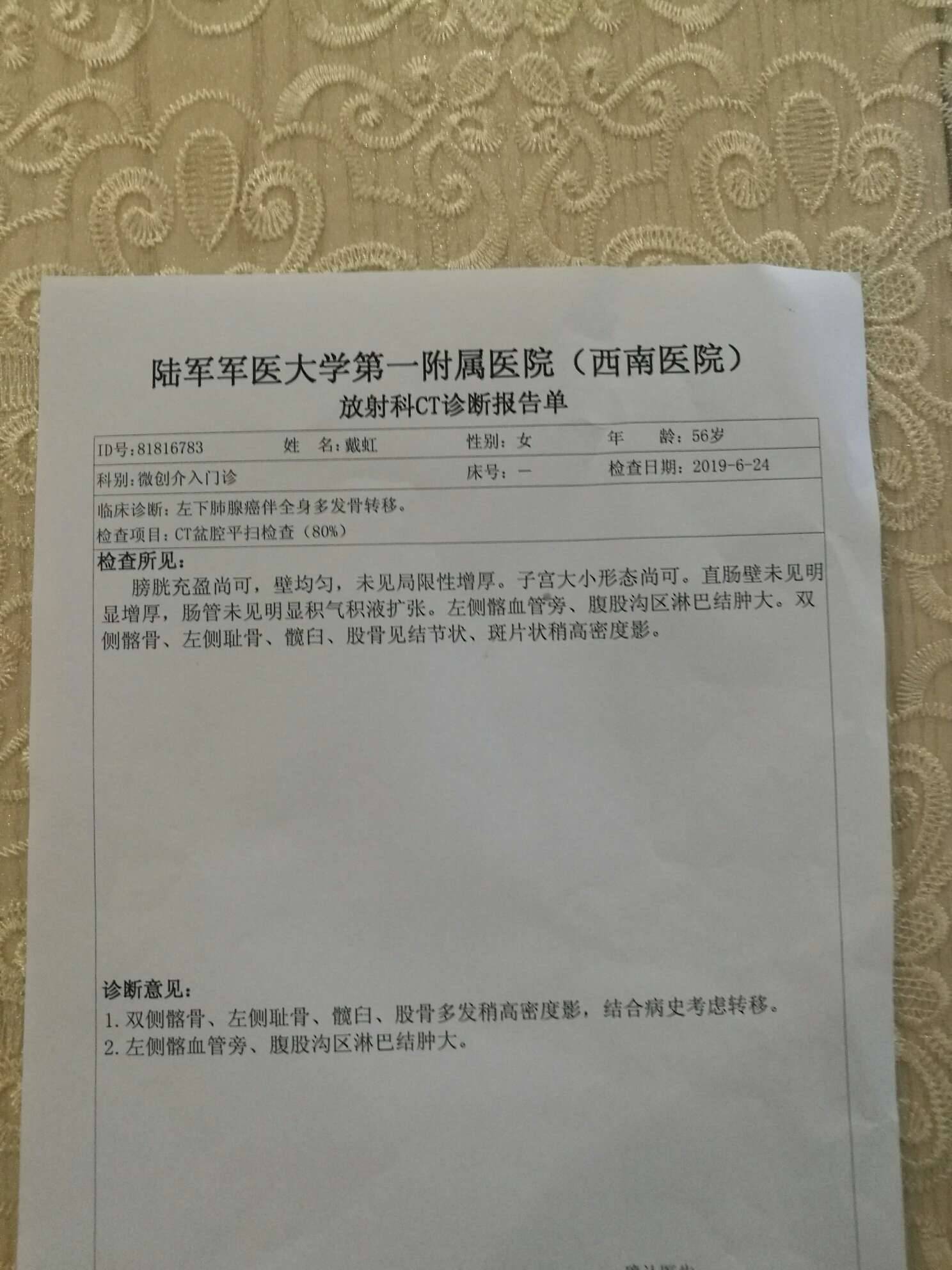 目前骨转移的左脚疼痛并水肿,"唑来膦酸打了六次,今天取了ct