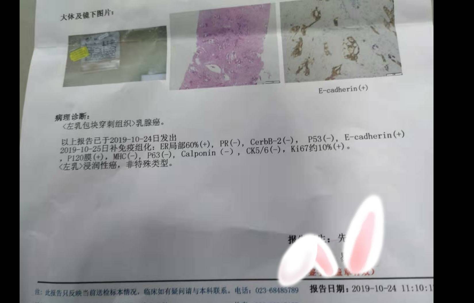 姐妹们,求助,我这个乳腺癌是什么分型呢。好治疗吗?-图1