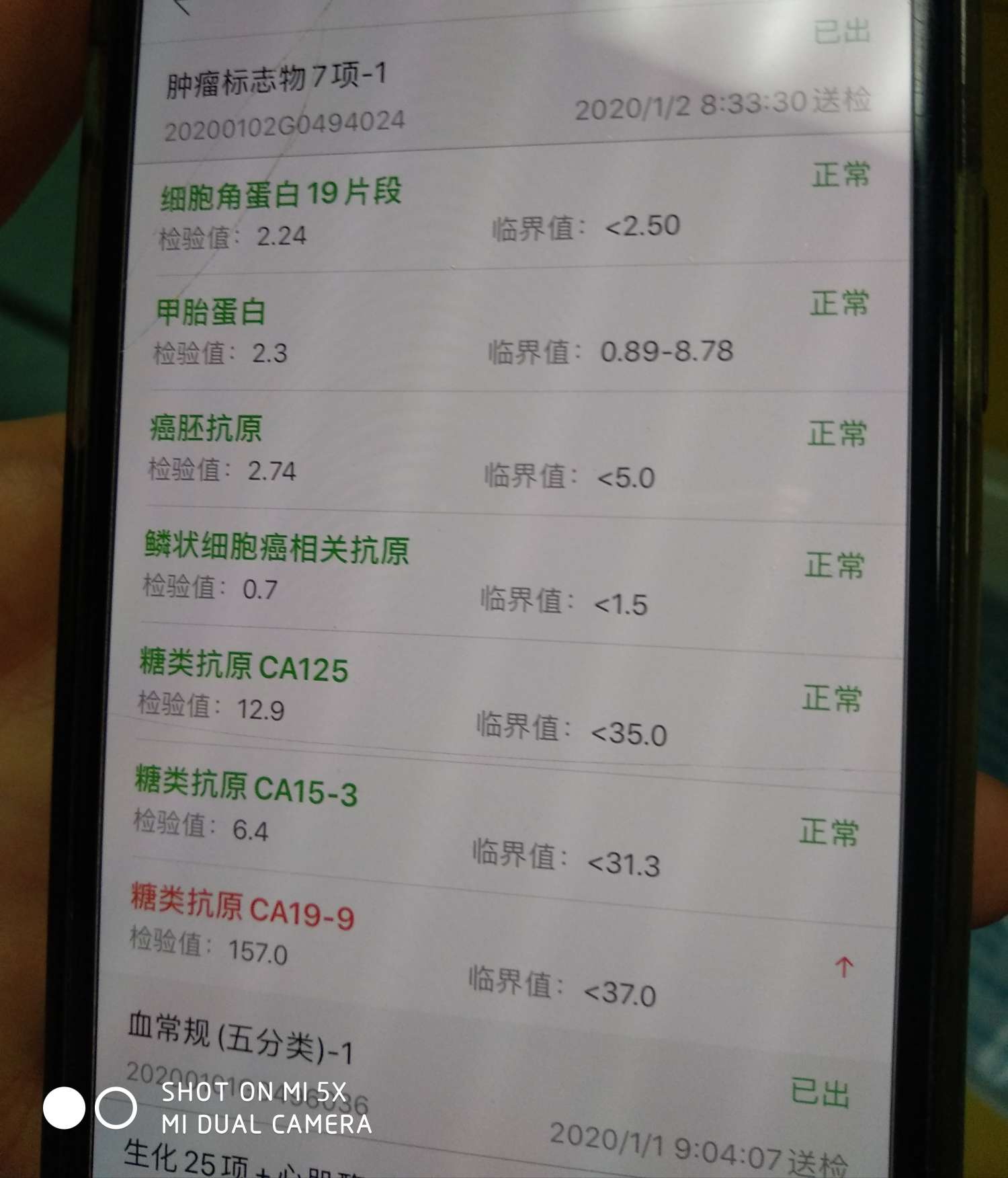 三阳乳腺癌术后肿瘤标志物ca199一直很高怎么办