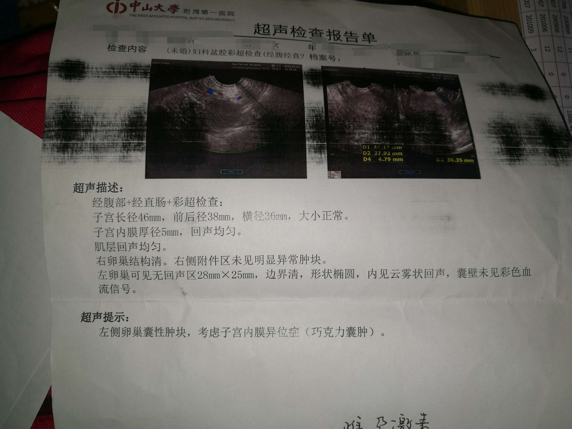 子宫肌腺症 子宫腺肌症_子宫b超能检查出来是不是内膜异位吗_子宫内膜异位症怎么检查