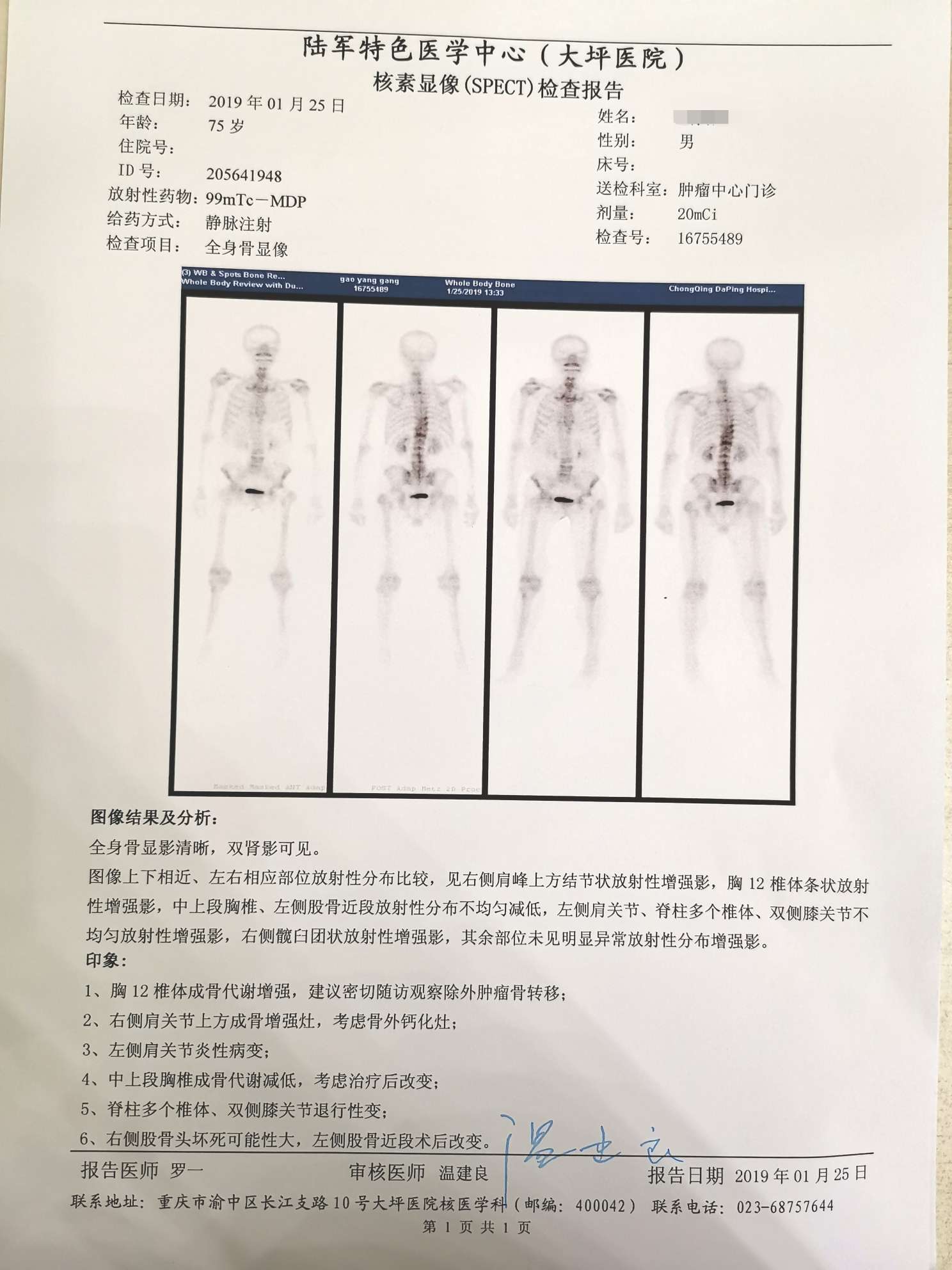 说说爸爸的骨扫描后的经历