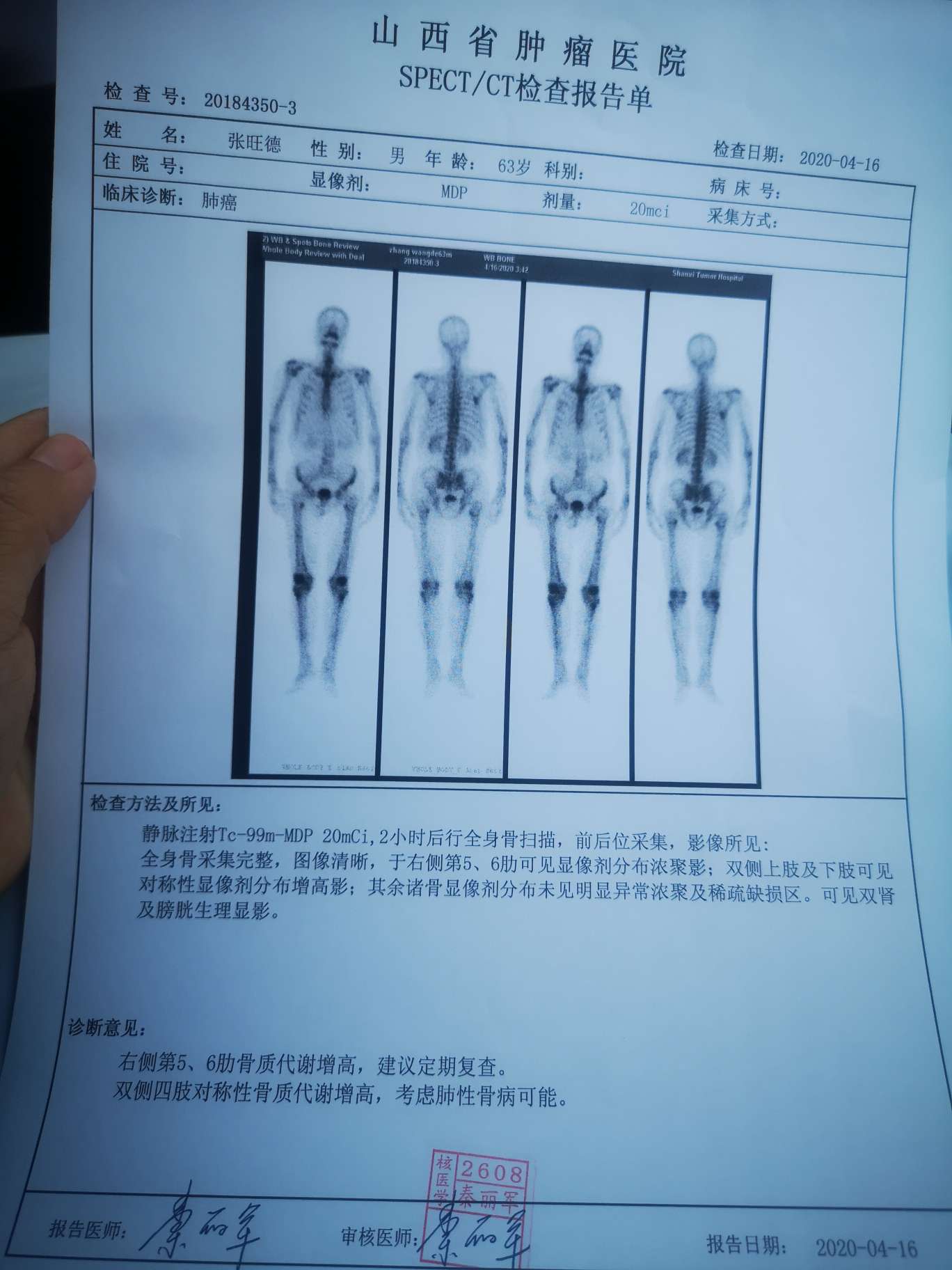 爸爸的骨扫描报告