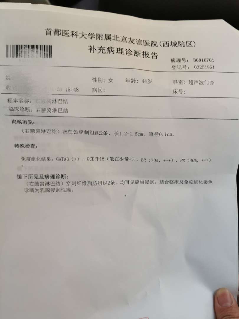 今天刚取到乳腺穿刺免疫组化报告