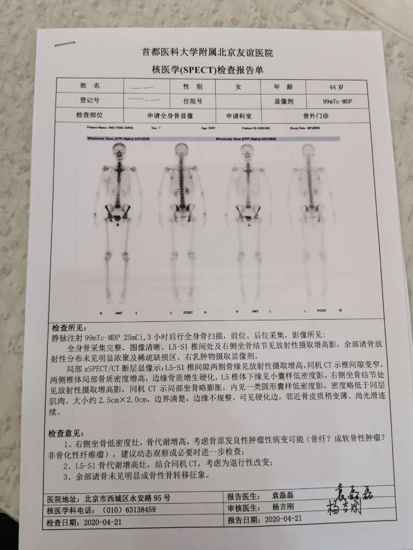 我的骨扫描结果