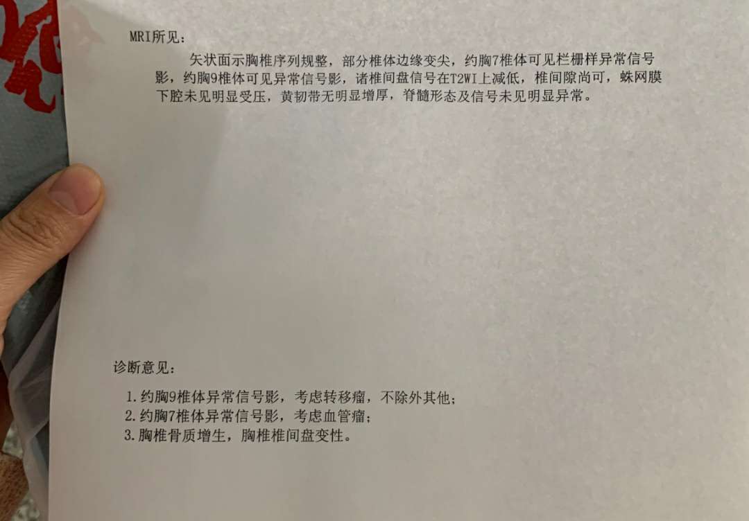 ct有变化了,盆腔积液这个严重不?