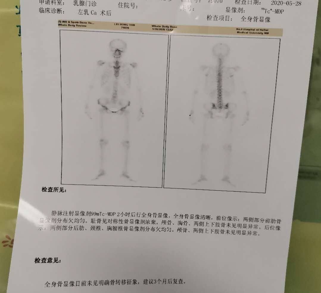 昨天做的骨扫描,谁帮忙给看看,3个月复查?