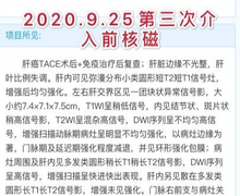 第三次介入,准备把pd1的药也一起用了