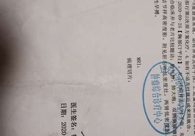 二次免疫后CT