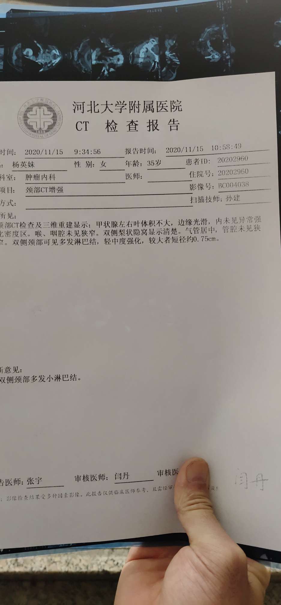 请看看这是不是转移啊,做彩超没发现,加强ct就写着有小淋巴结