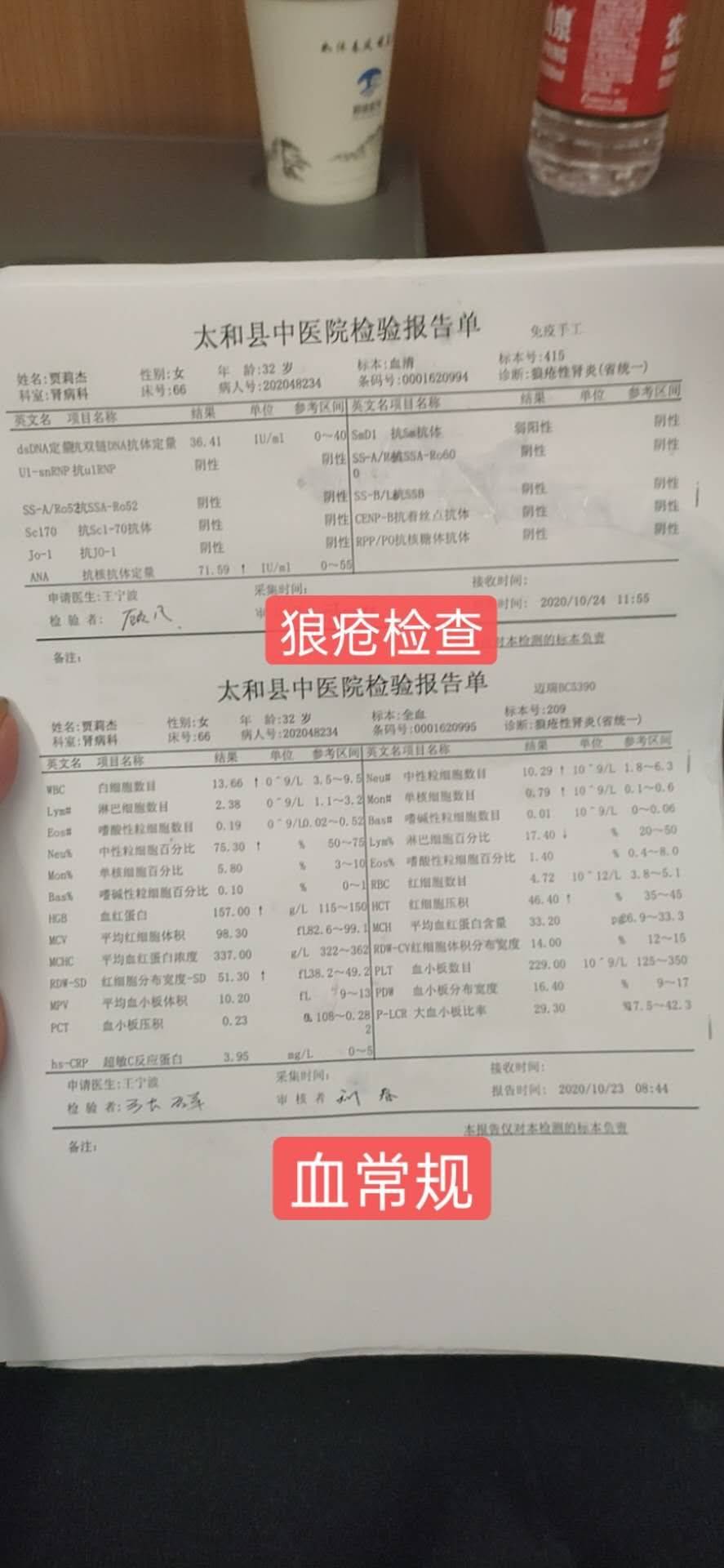 10月份的化验单-系统性红斑狼疮康复圈-觅健