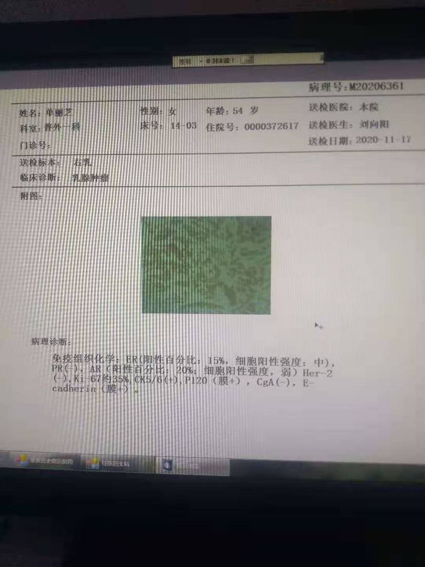 借了病理白片重新化验结果不一样了你们有过这样情况吗第一次