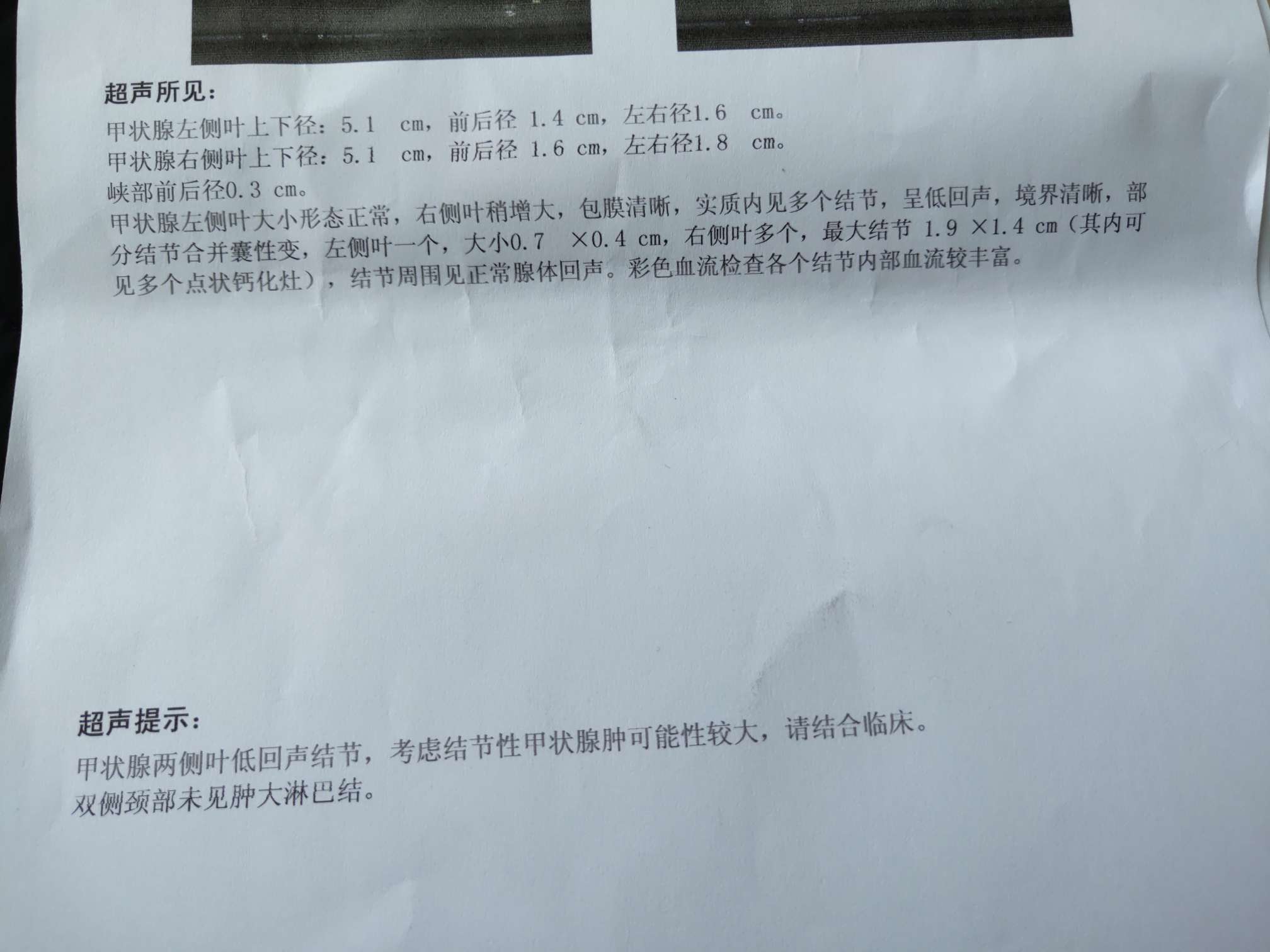 请问我这个甲状腺结节需要手术吗?看了医生,有的建议开刀,担心有恶