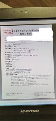 我从5月切除四分之三胃后医生做出sox化疗方案,建议8次。但是从