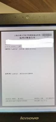 我从5月切除四分之三胃后医生做出sox化疗方案,建议8次。但是从