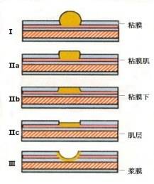 1497840085601097.jpg 1.jpg