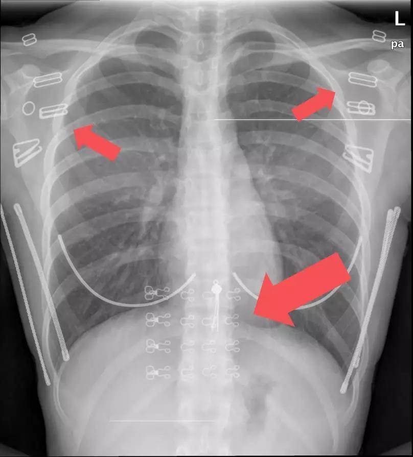 1557198345110878.jpg 1.jpg