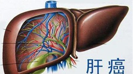 1558928645911293.png image.png