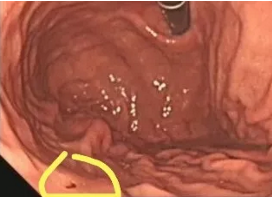 1559179896935404.png 1559179896935404.png