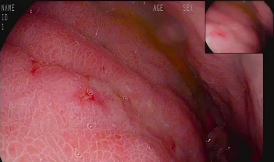 1559180010373505.png 1559180010373505.png