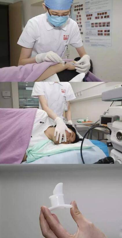 胃镜检查开始.jpg