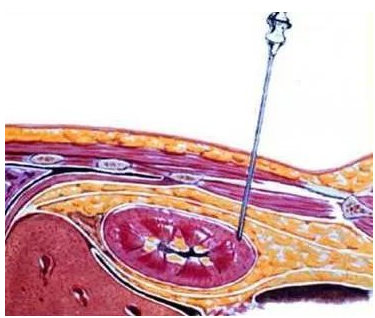 1567499530506888.png 百度图片.png