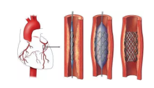 1567563390942107.png image.png