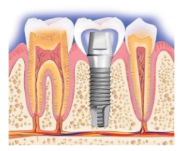 1567563413453901.png image.png