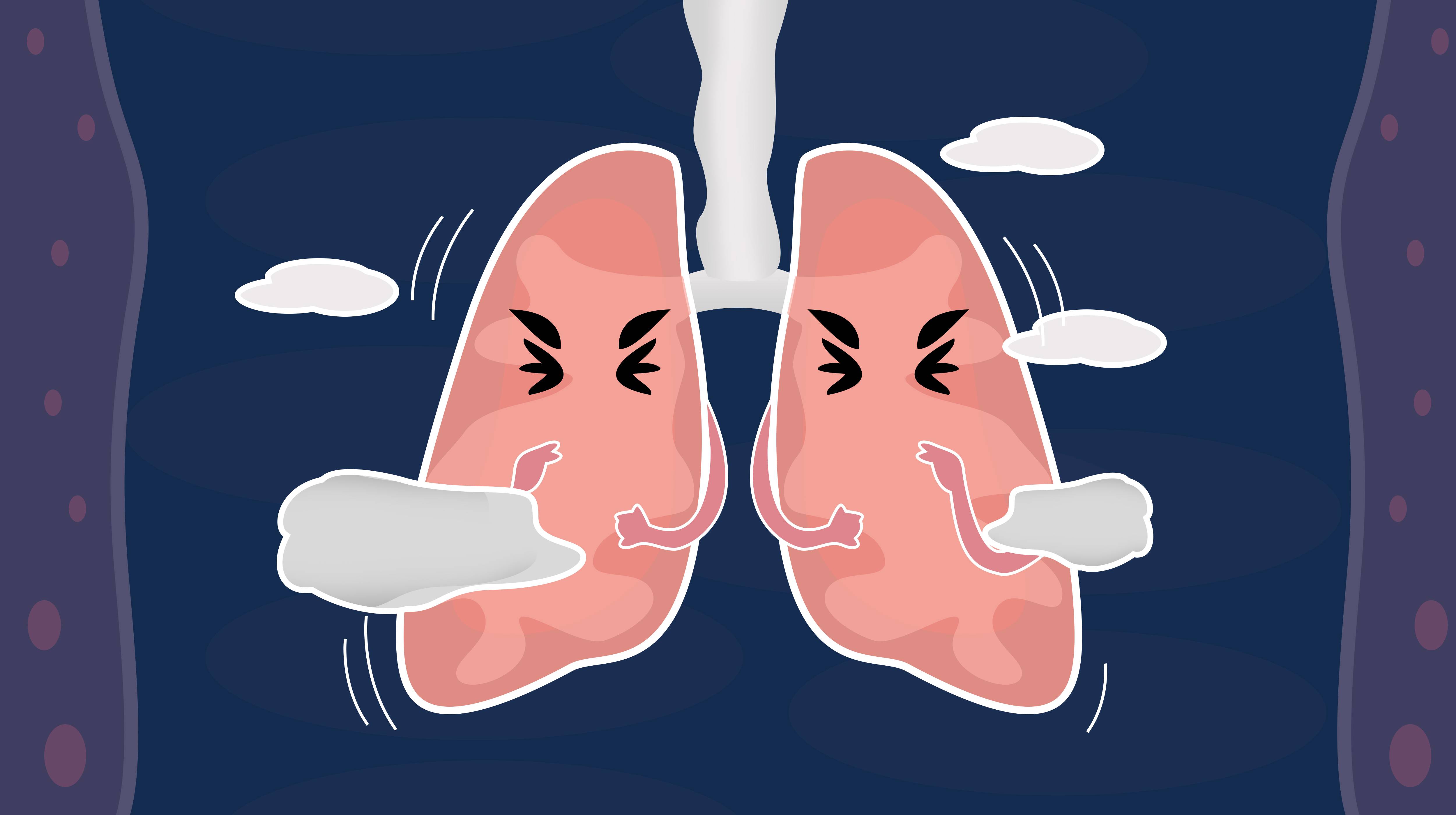 不同类型的咳嗽诊疗经验，要点浅析-专业文章