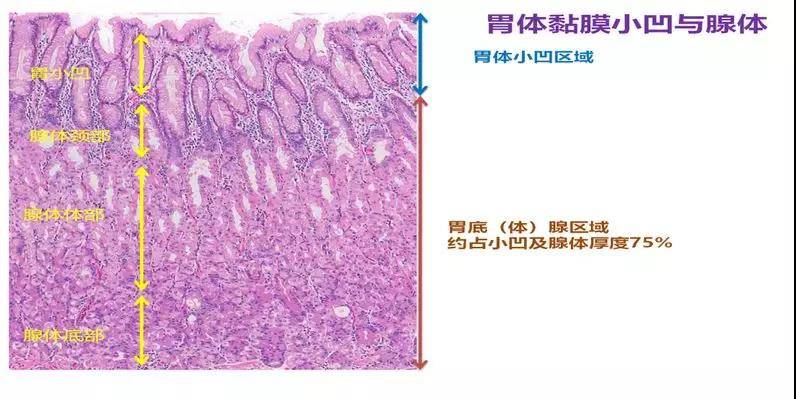 胃癌病理基础知识大盘点