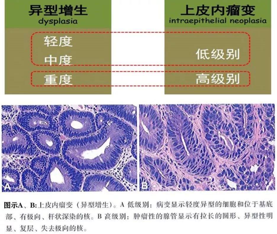 胃癌病理基础知识大盘点