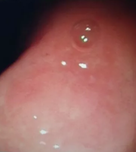 1579405084612189.png 搜狗截图20年01月19日1137_7.png