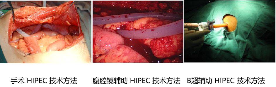 1583906616387320.jpg 7.jpg