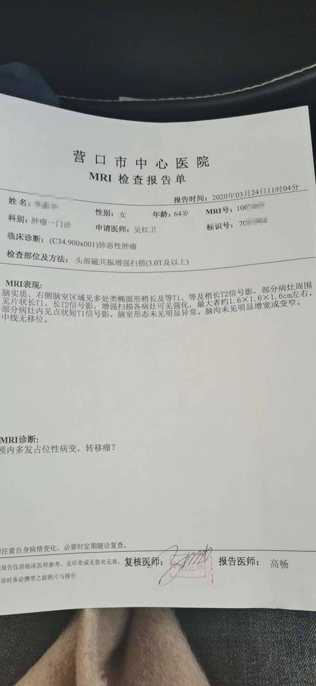 肿标下降纵隔淋巴结却肿大了是什么原因