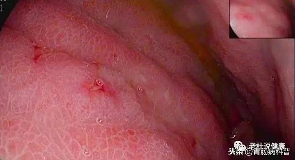 1596680308482069.jpg 6407be55a45bf4384c6b395cf2e9cea5.jpg