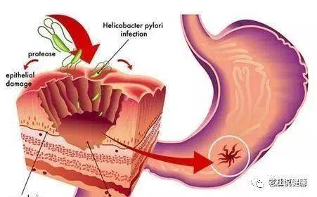 1596680327653783.jpg 6a6760e9a16b30a2672eddf7ae4ac30f.jpg