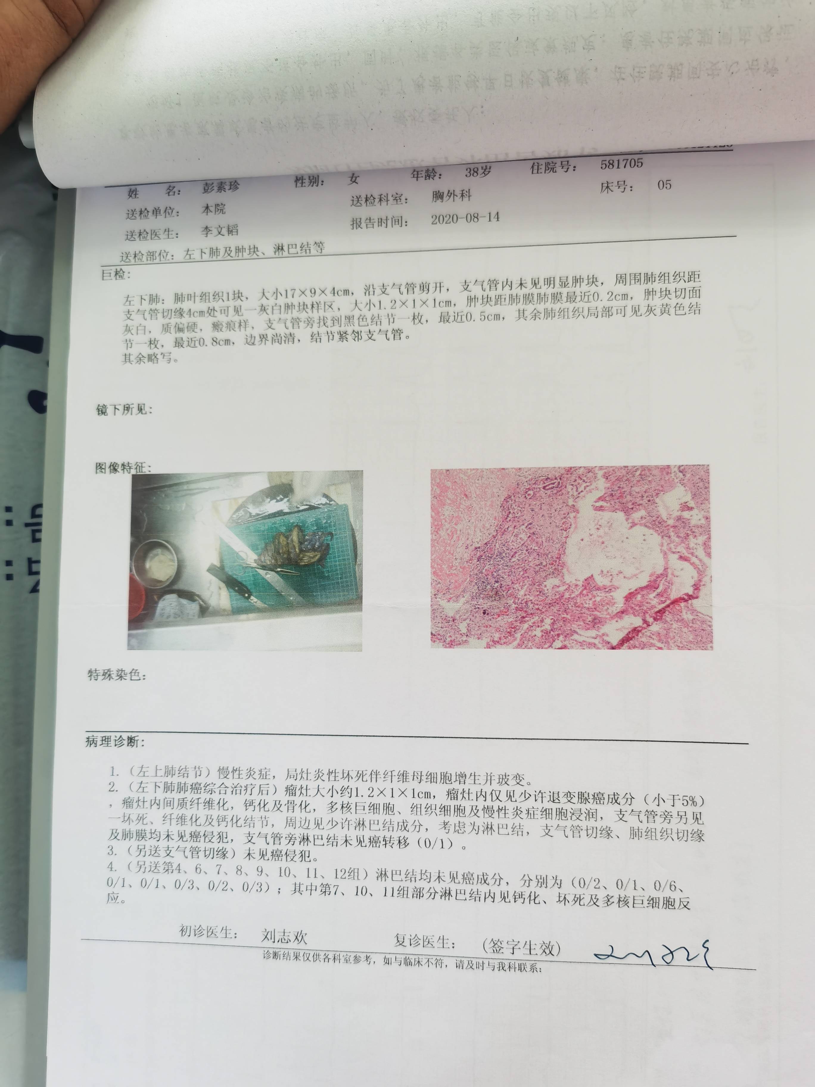 病理报告-肺癌康复圈-觅健