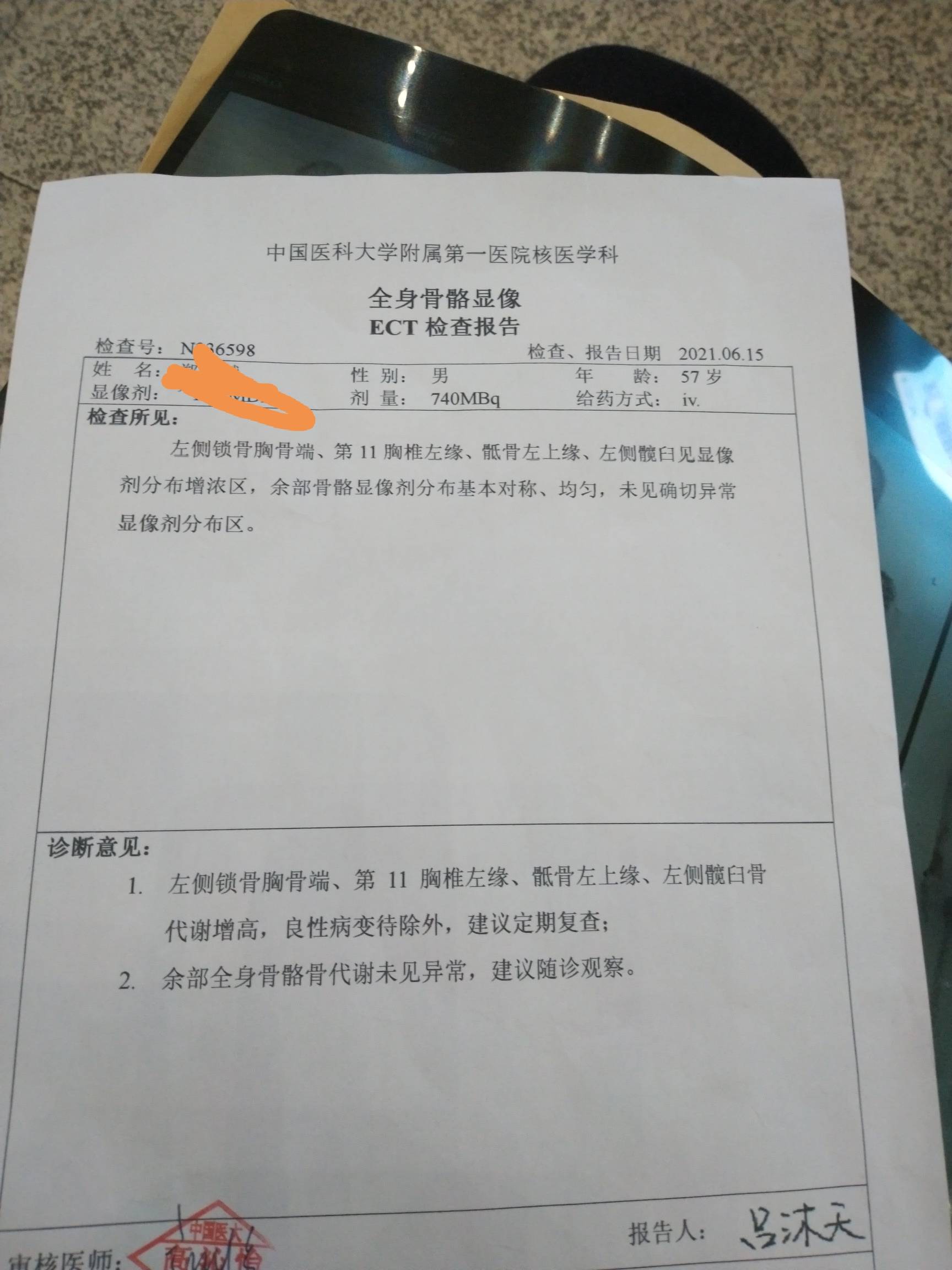 肺腺癌术后一年半,小腿迎面骨痛做的骨扫描,胸椎和骨盆核磁,骨盆ct