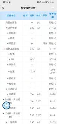ALK突变,淋巴、脑转移,9月15日开始服用阿来替尼,10月15
