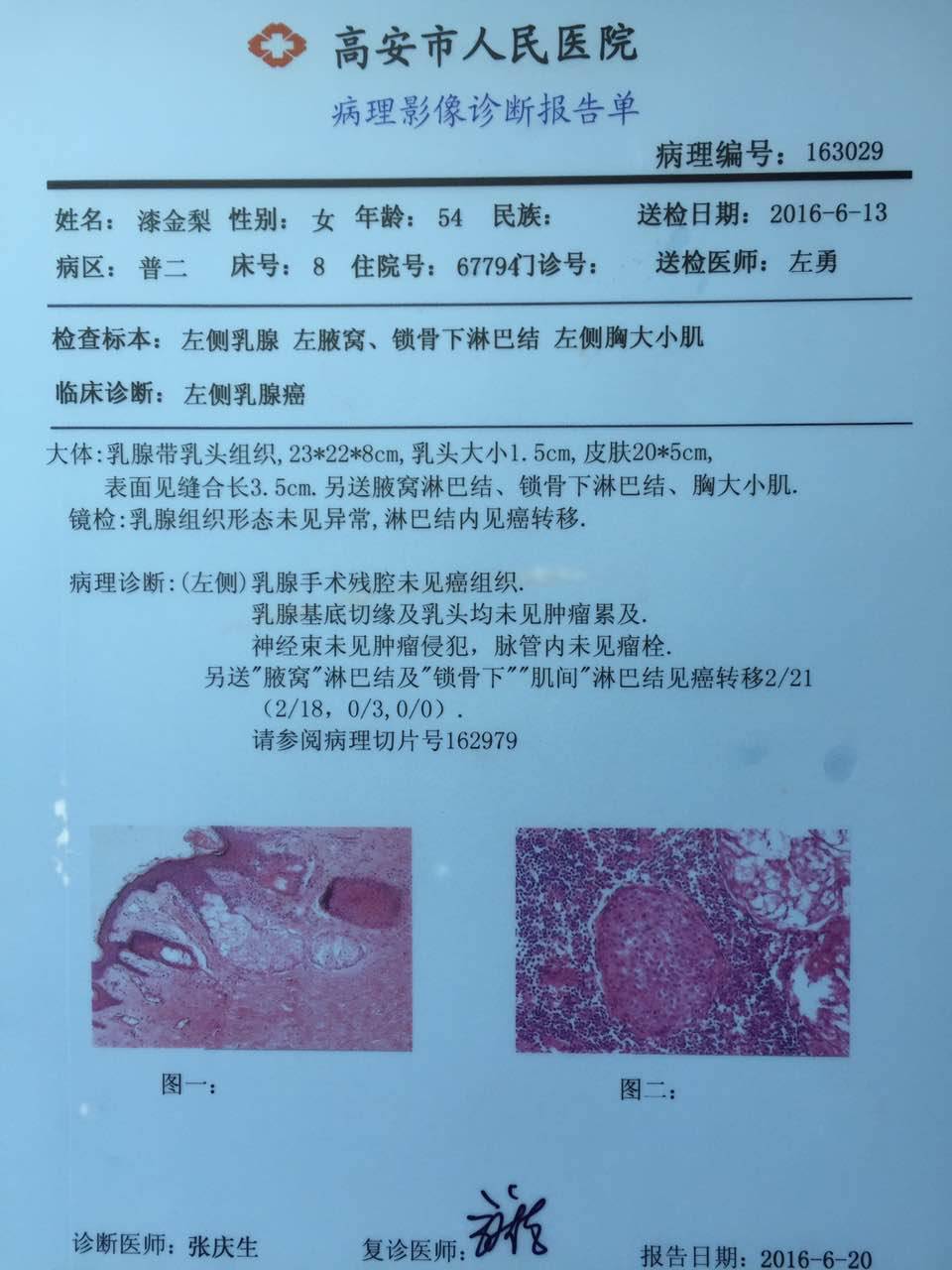 乳腺纤维瘤病理报告图片