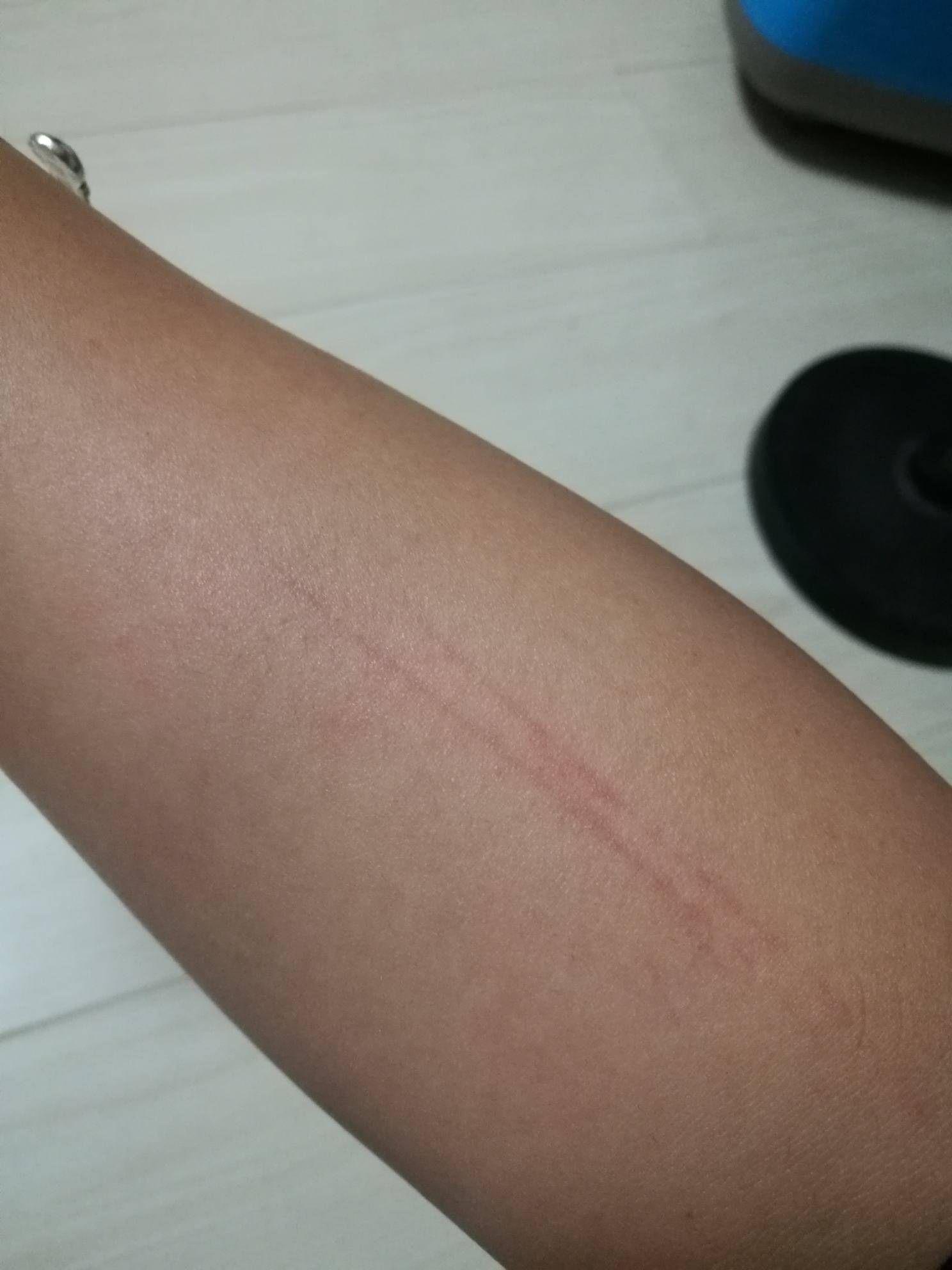 胳膊上两天红线